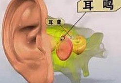 鸣天鼓正确手法视频,精准动作与技巧全解析